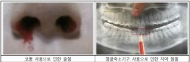 안전사각지대 놓인 ‘셀프 성형기구’