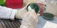 ‘비브리오패혈증 주의보’…서해안 포구서 올해 첫 비브리오패혈증균 검출