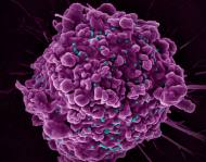 HIV 잠복 유지하는 숙주 단백질 경로 확인…치료 표적 가능성 제시