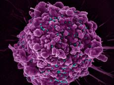 HIV 잠복 유지하는 숙주 단백질 경로 확인…치료 표적 가능성 제시