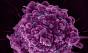 HIV 잠복 유지하는 숙주 단백질 경로 확인…치료 표적 가능성 제시